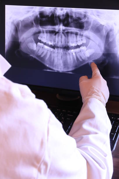 Best Dental Abscess Treatment in Iyanbito, NM